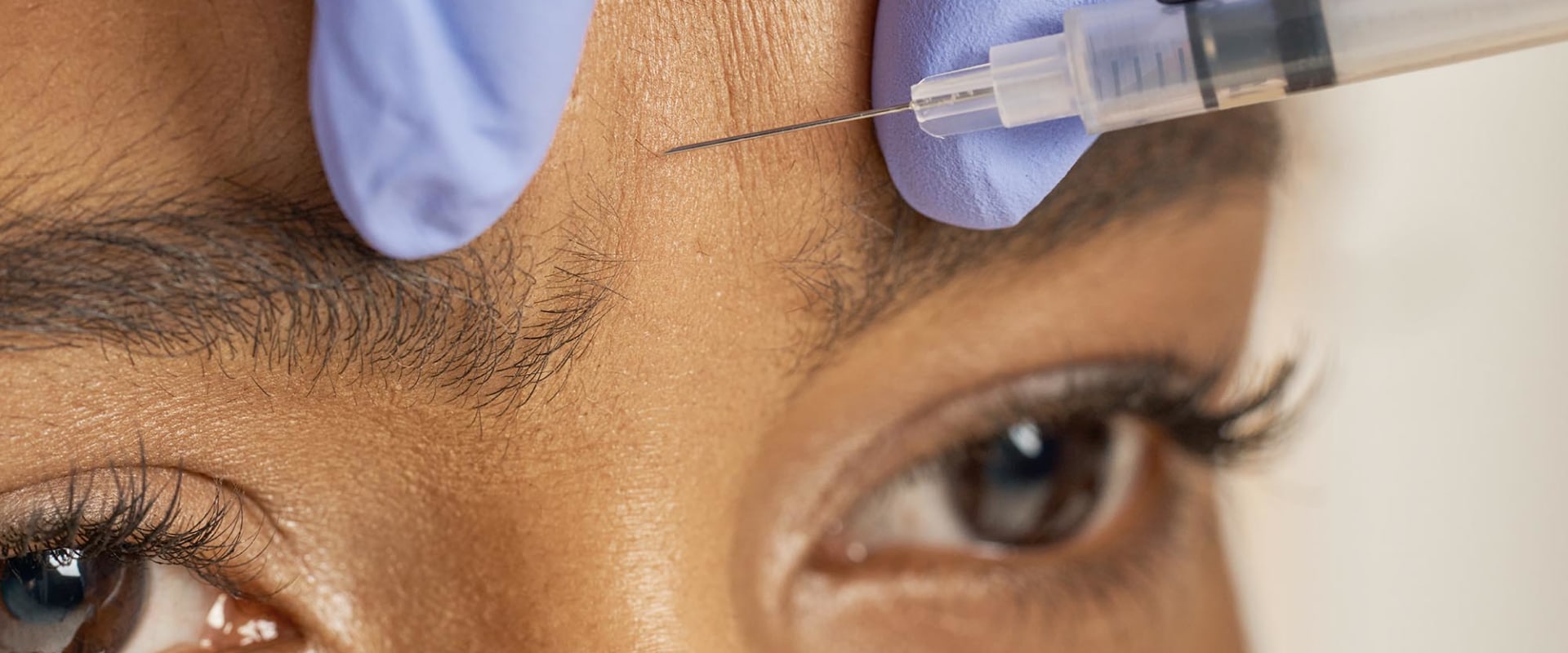 Who Can Administer Botox Safely and Legally?