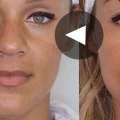 Will Botox Raise My Eyebrows? A Non-Surgical Brow Lift Alternative