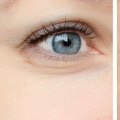 Can Botox Really Eliminate Wrinkles? An Expert's Perspective