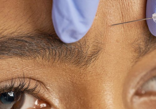 Who Can Inject Botox? An Expert's Guide