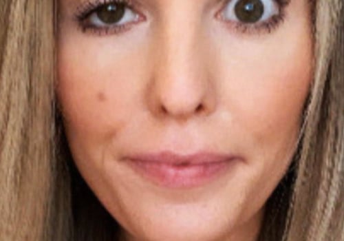 When Does Botox Cause Eyelids to Fall Out?