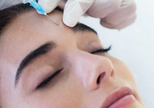 What is Botox and How Does it Work?