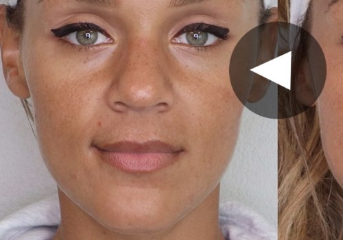 Will Botox Raise My Eyebrows? A Non-Surgical Brow Lift Alternative